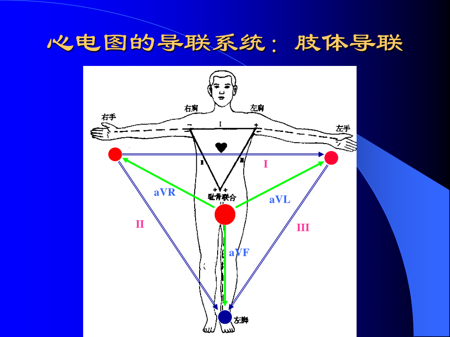 急诊科常见异常心电图.ppt_第3页