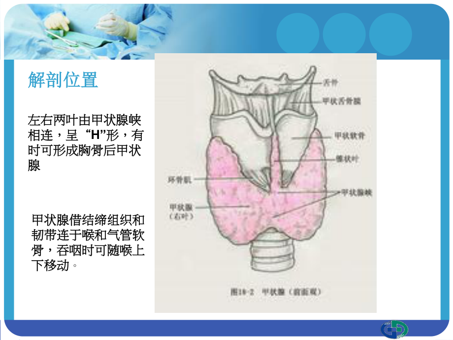 甲状腺切除术个案分享.ppt_第3页