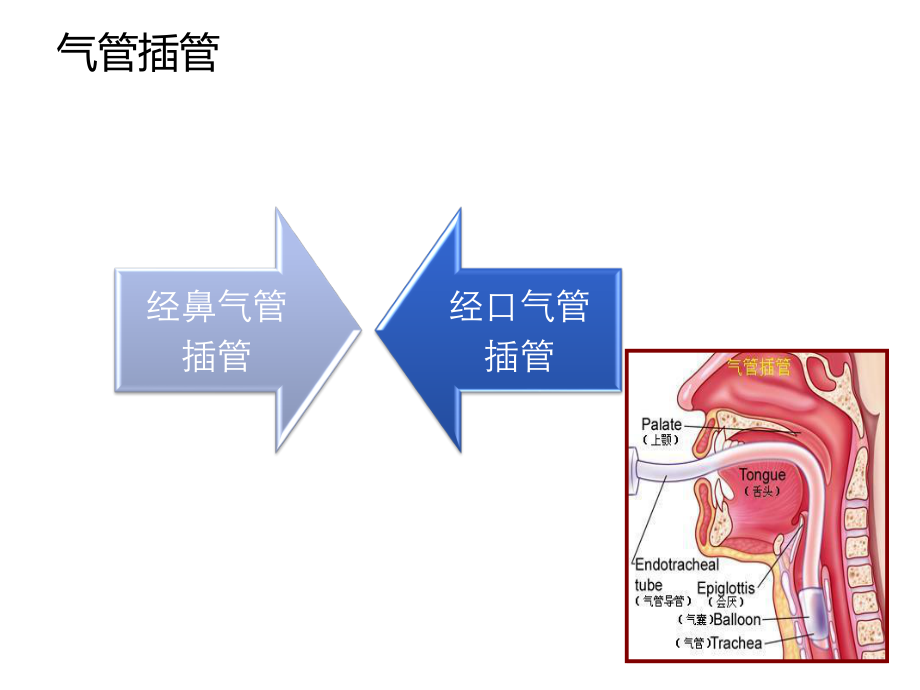 气管插管和气道湿化.ppt_第3页