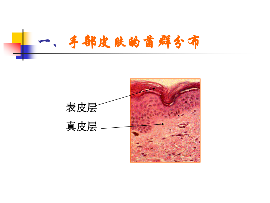 手卫生与医院感染的控制.ppt_第3页