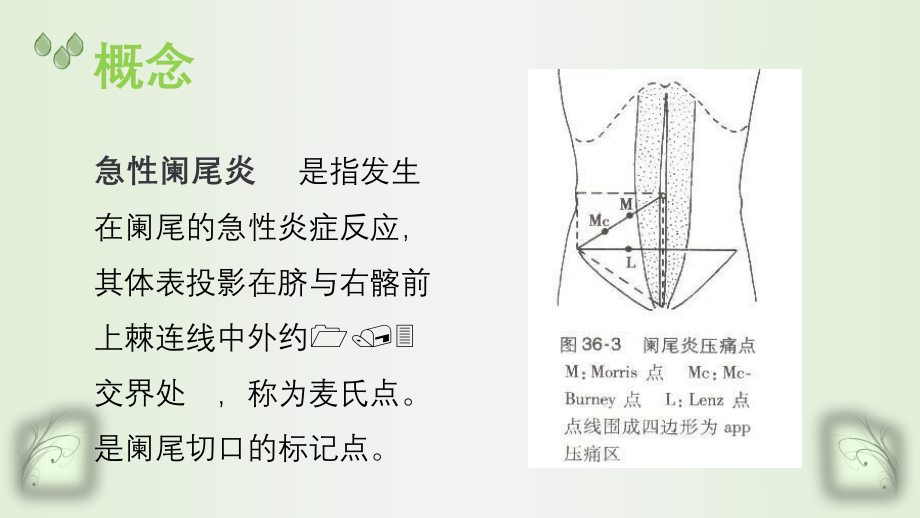 急性阑尾炎(1).pptx_第3页