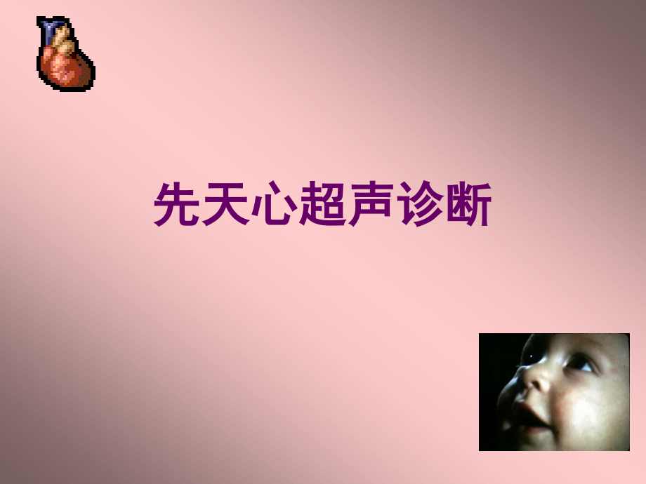 胎儿超声心动图.ppt.ppt_第1页