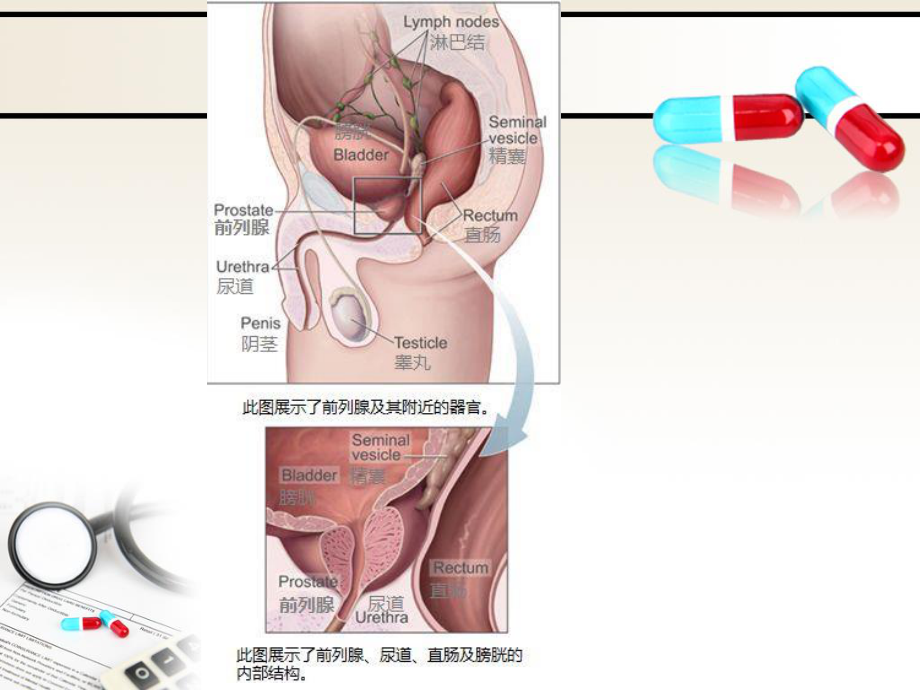 泌尿系统—前列腺.ppt_第3页