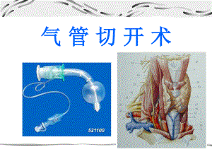 气管切开术.ppt.ppt