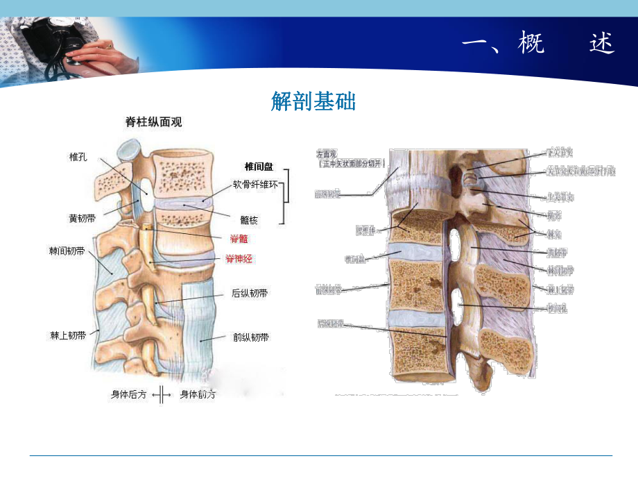 腰椎间盘突出康复.ppt_第3页