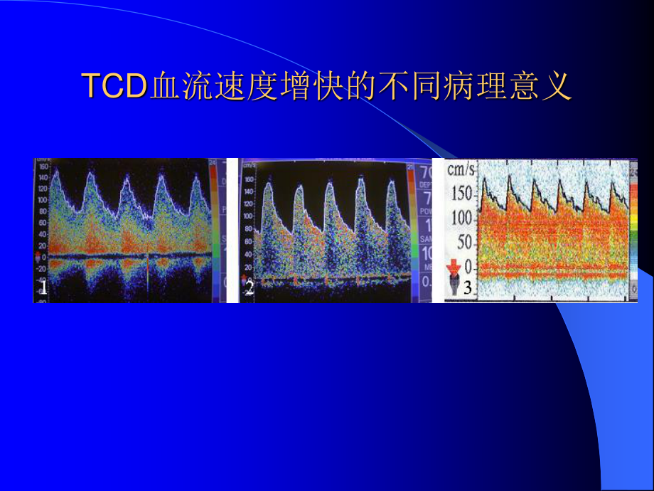 血管流速快慢的意义.ppt_第3页