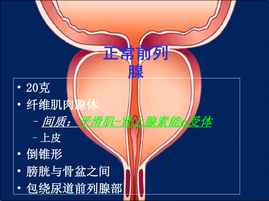 泌尿系统梗阻PPT.ppt_第3页