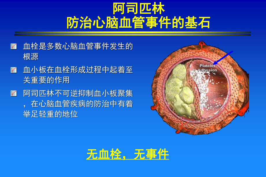 服用小剂量阿司匹林每人每年仅增加出血患者.ppt_第3页