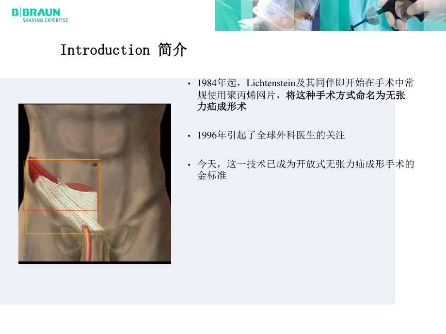 李金斯坦无张力疝手术方法步骤.ppt_第2页