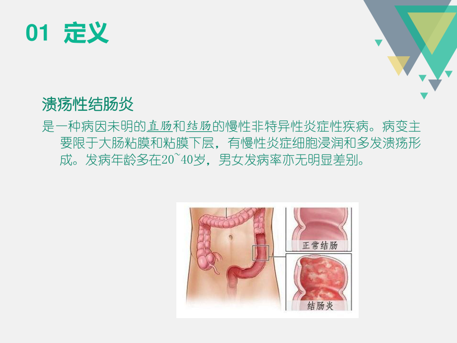 溃疡性结肠炎教学查房.ppt_第3页