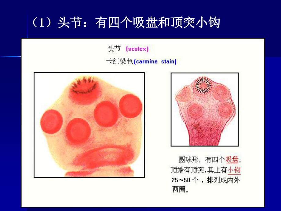 寄生虫-猪带绦虫.ppt_第3页