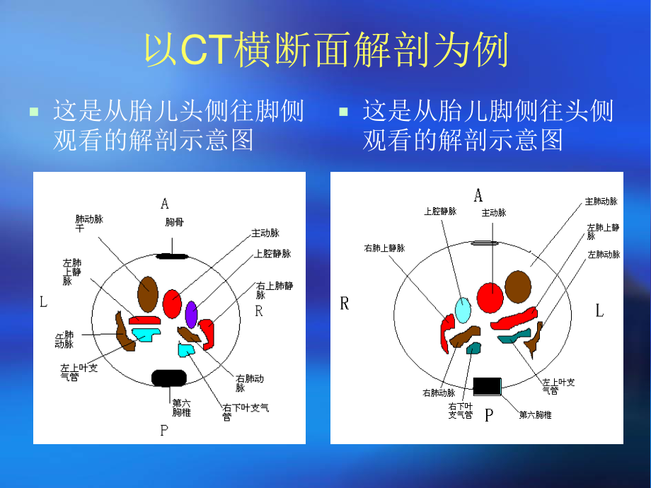 胎儿心脏检查步骤.ppt_第3页