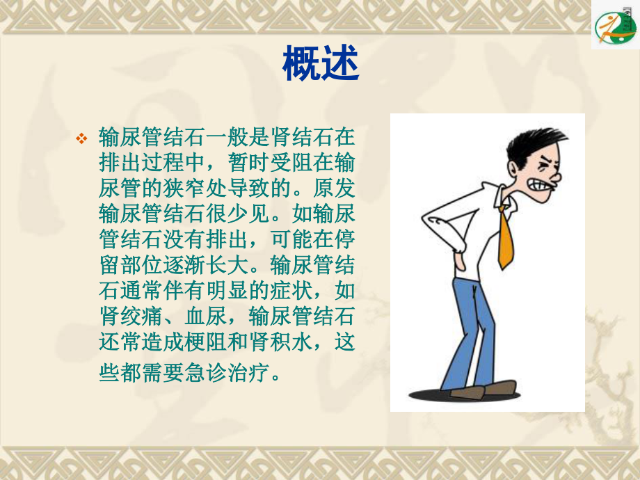 输尿管结石及钬激光碎石术.ppt_第2页