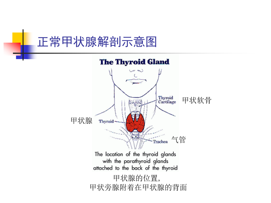 甲状腺功能亢进症PPT.ppt_第3页