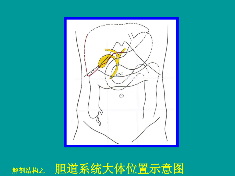 急性化脓性梗阻性胆管炎.ppt_第3页