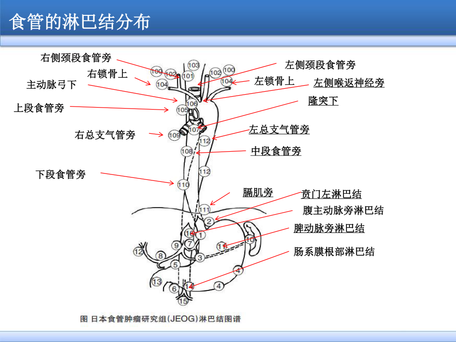 食管癌淋巴结三野清扫.ppt_第2页