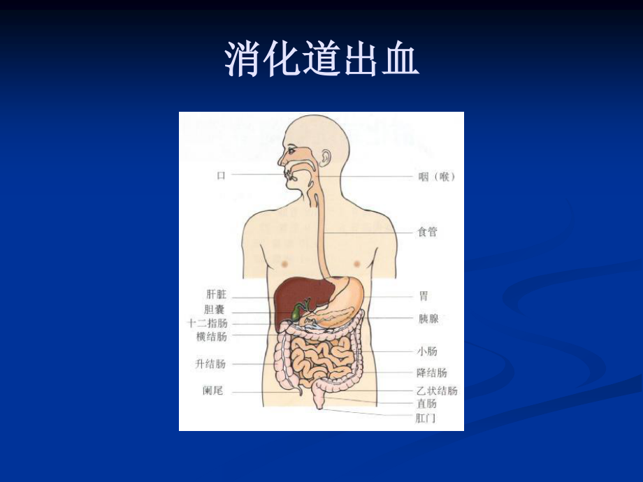 呕血与便血2.ppt_第2页