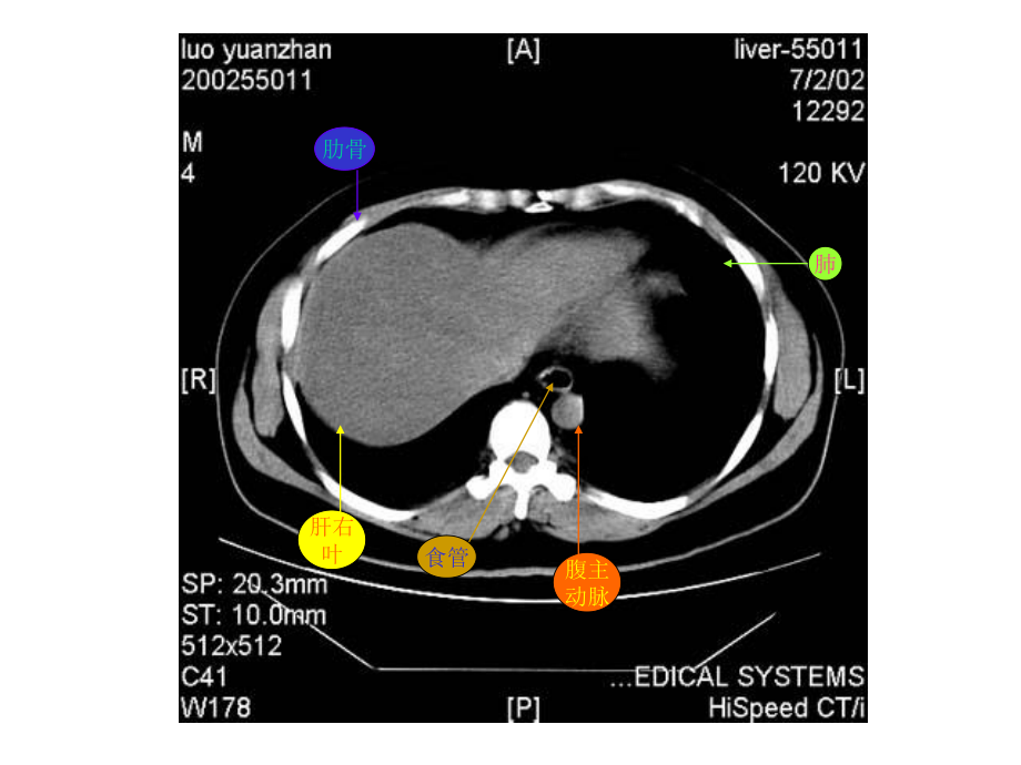 教你认识腹部CT.ppt_第2页