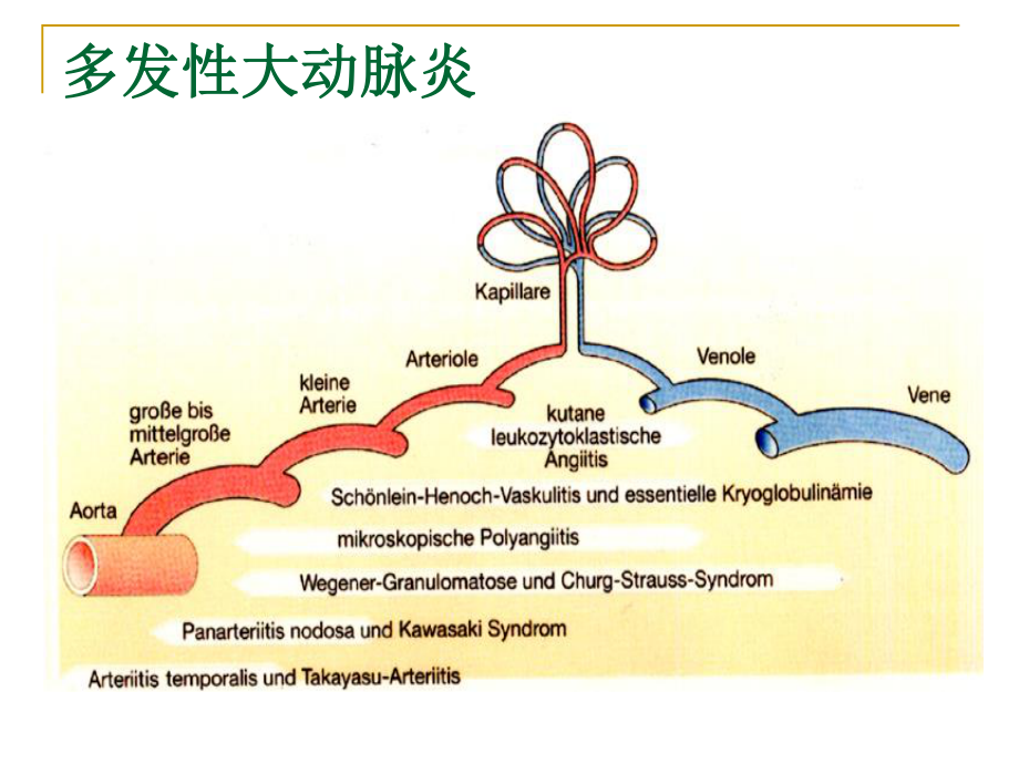 多发性大动脉炎1.ppt_第3页