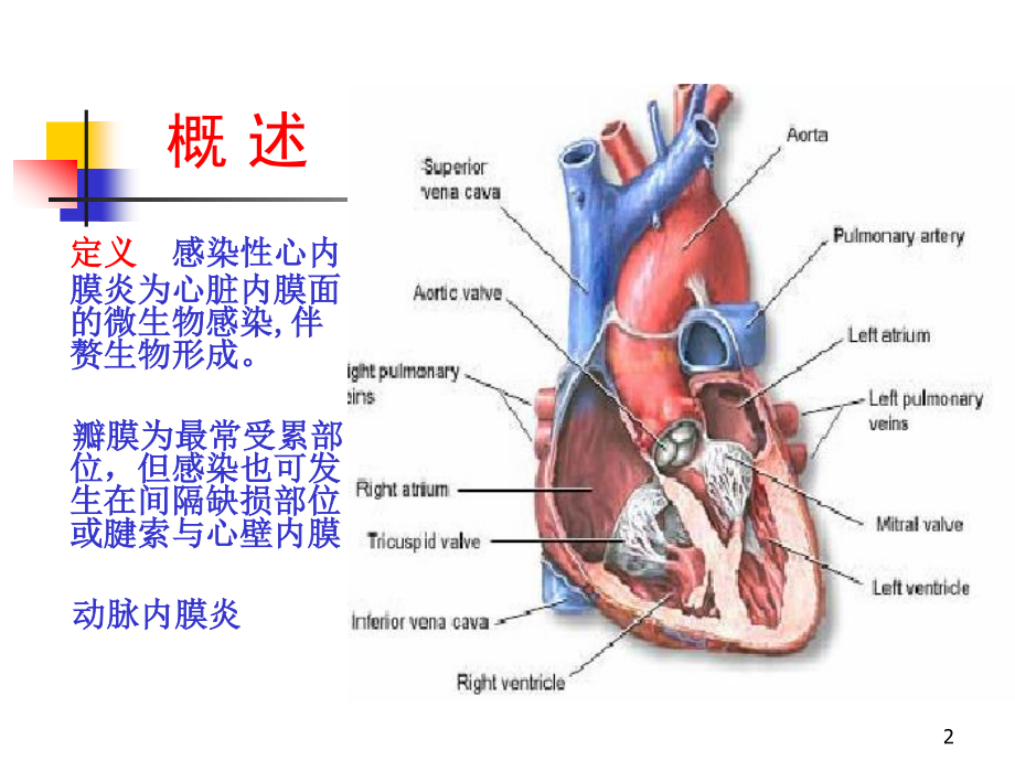 感染性心内膜炎(2学时).ppt_第2页