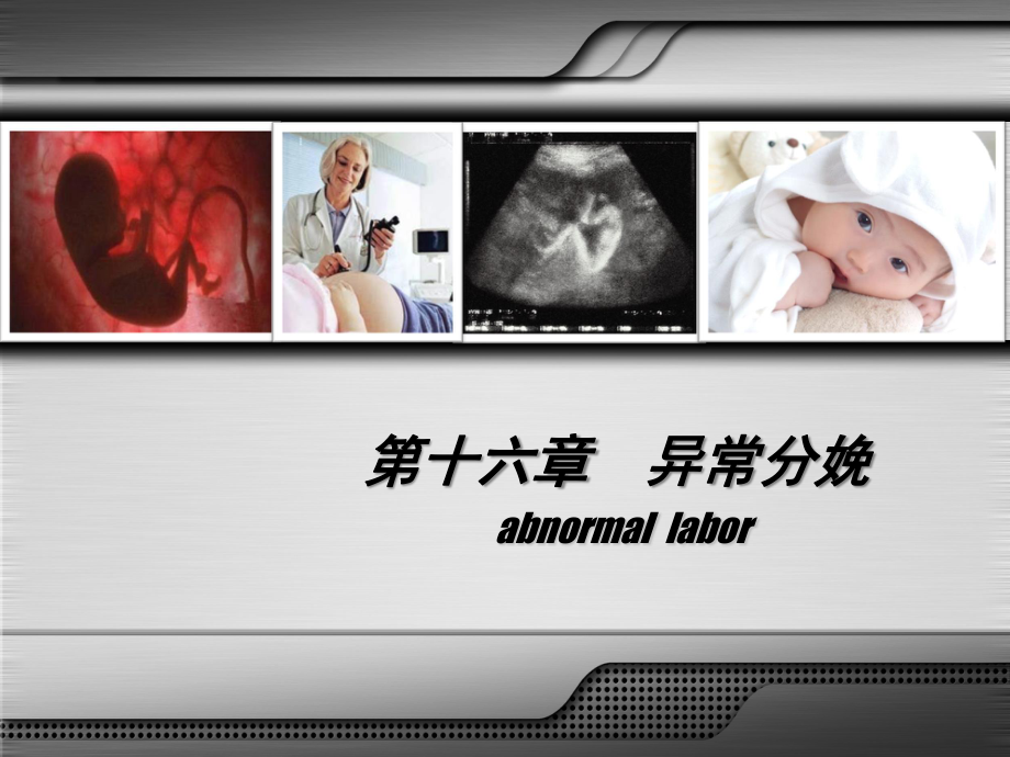 异常分娩的诊治要点.ppt_第3页