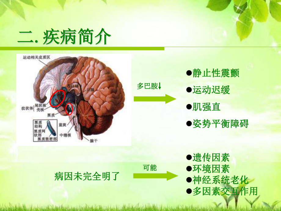 帕金森病患者康复训练.ppt_第3页