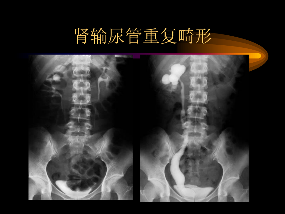 泌尿生殖图库1.ppt_第3页