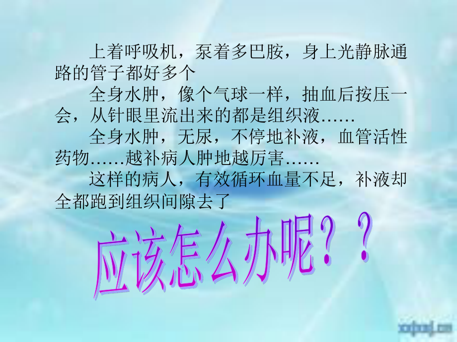 毛细血管渗漏综合征.ppt_第1页