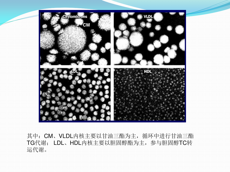 血脂构成及OS形成机理-高血脂症机理及靶点归纳.ppt_第3页