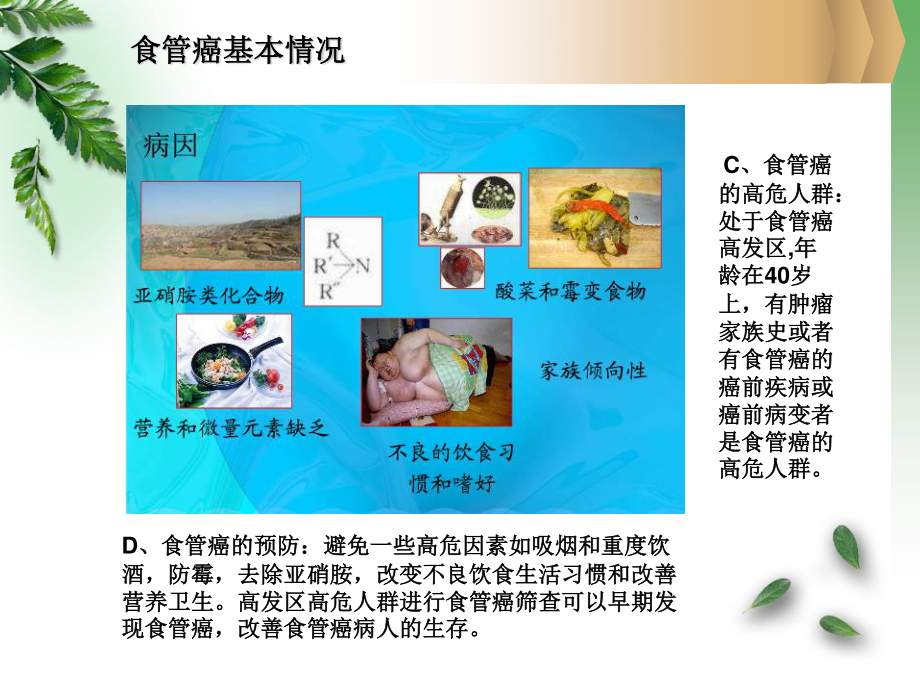 食管癌诊疗概述.ppt_第3页