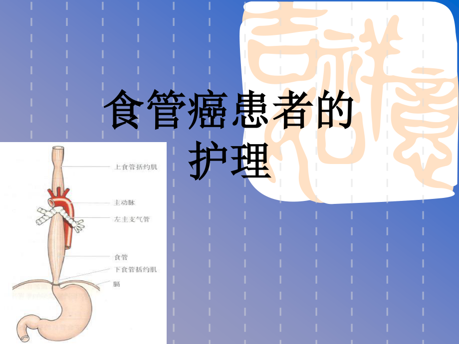 食管癌患者的.ppt_第1页