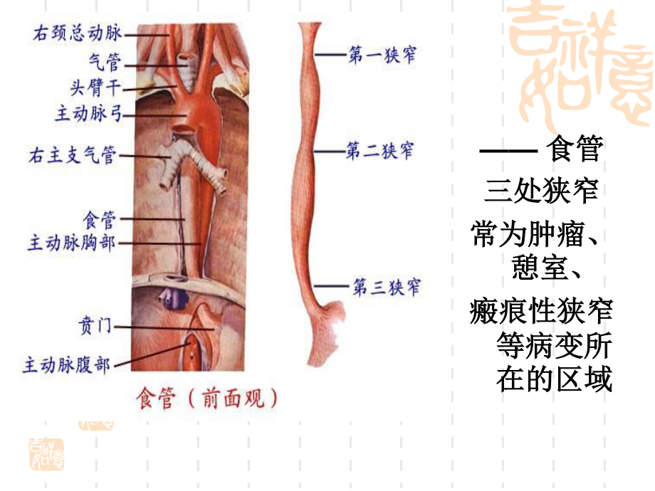 食管癌患者的.ppt_第3页