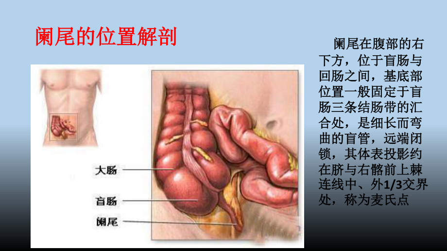 最新阑尾炎PPT.pptx_第3页