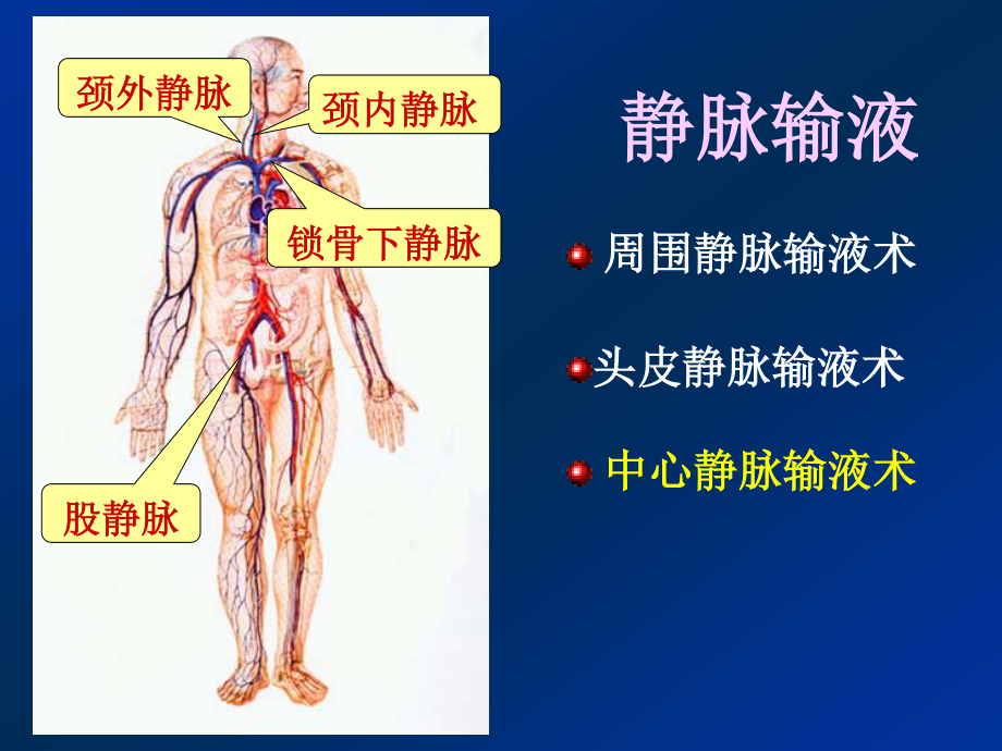 深静脉输液.ppt_第2页