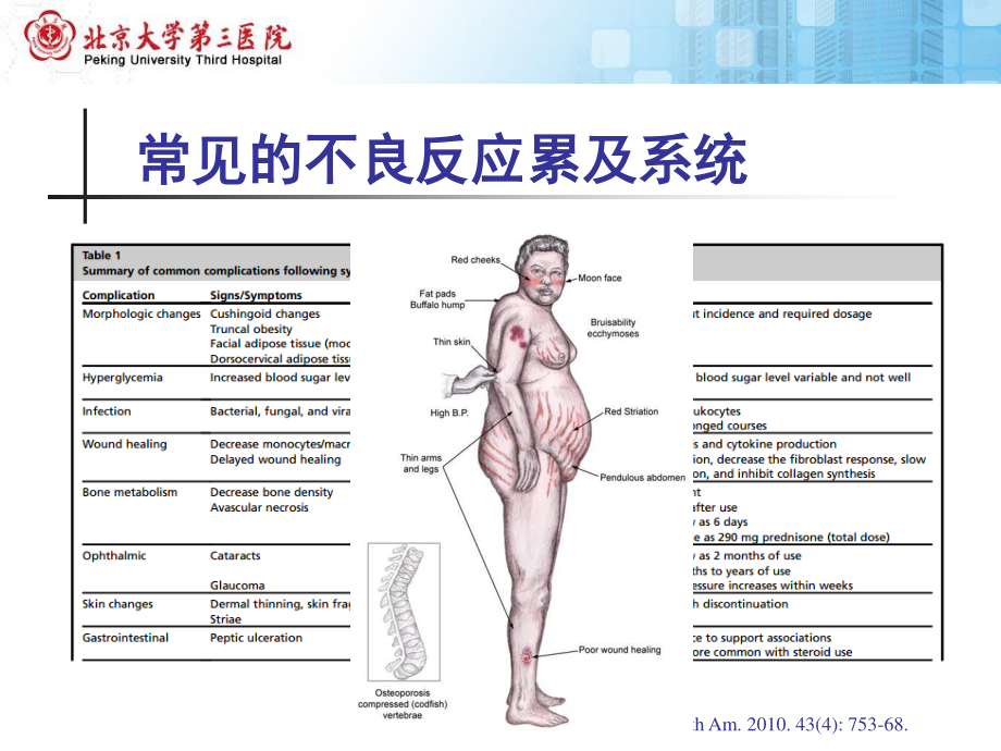 糖皮质激素不良反应概述北医三院.pptx_第3页