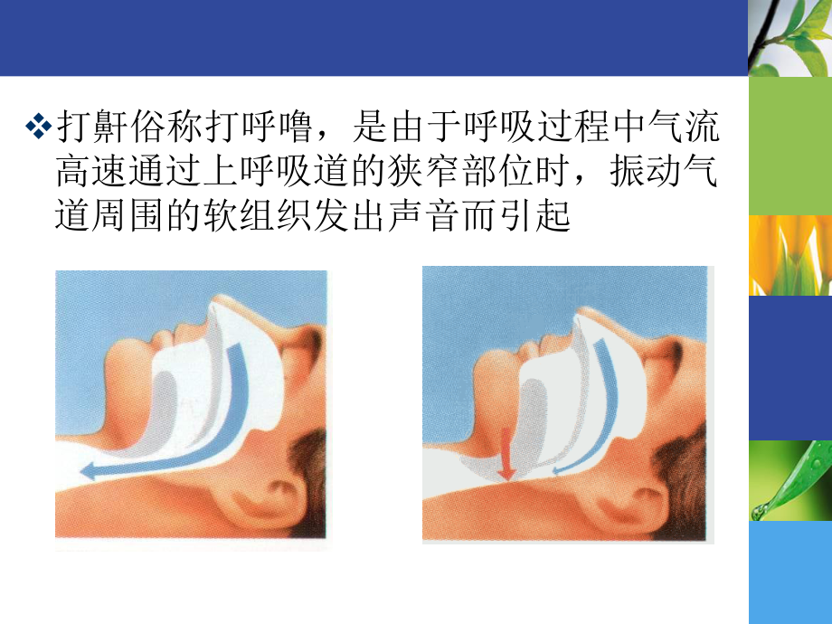 打鼾和和呼吸暂停.ppt_第3页