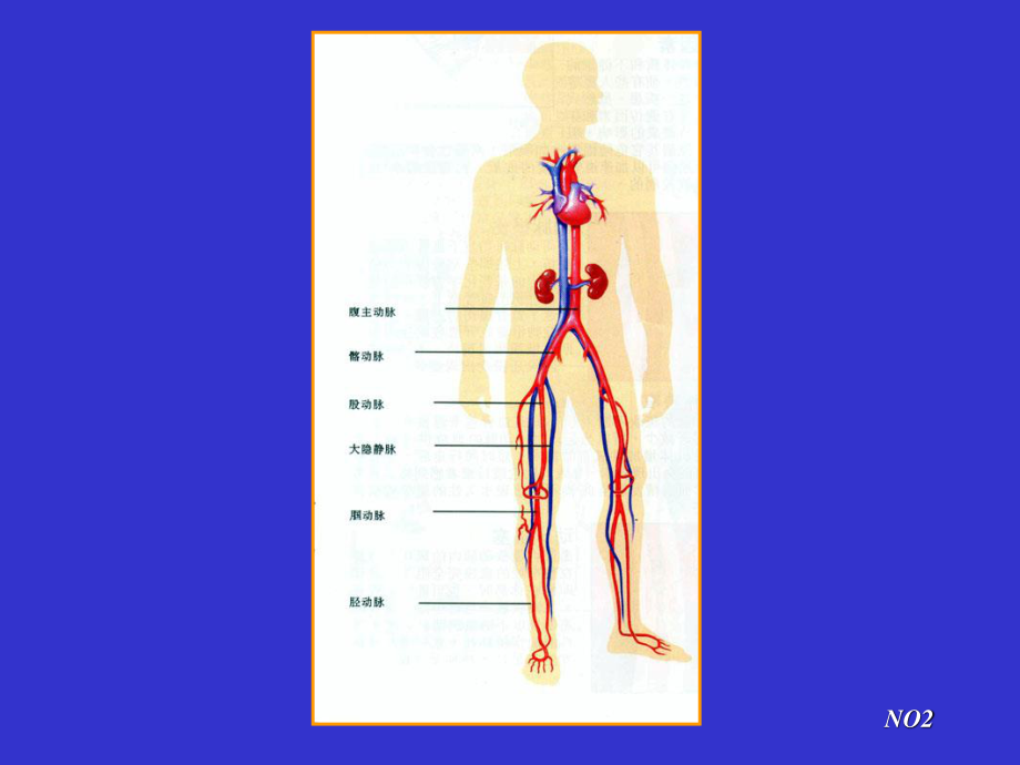 周围血管病.ppt_第2页