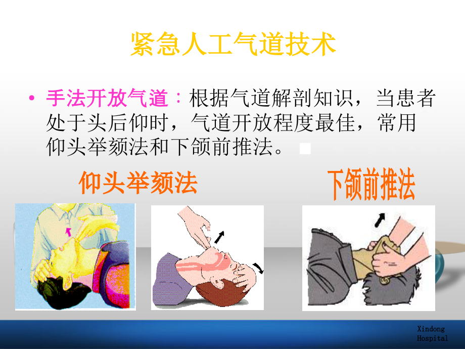 杜-气管插管术.ppt_第3页