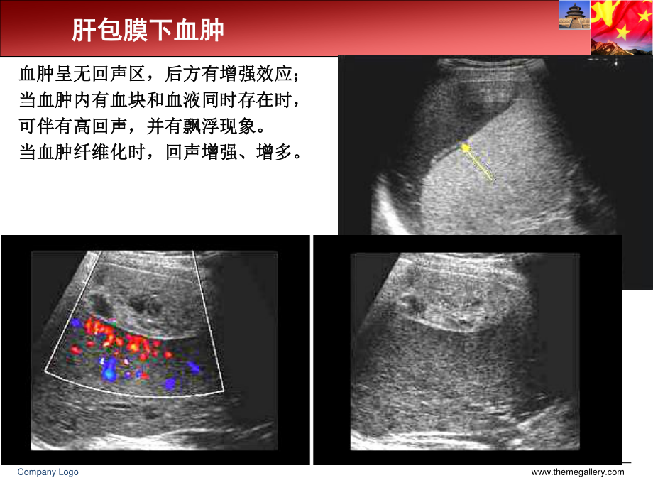 急诊超声的检查与分析.ppt_第3页