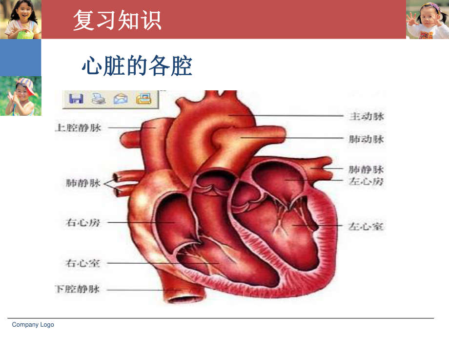 室间隔缺损教学查房.ppt_第3页