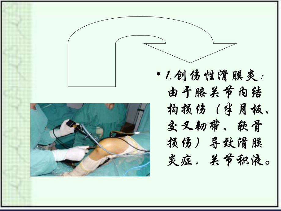 滑膜炎用药指导浅论.ppt_第3页