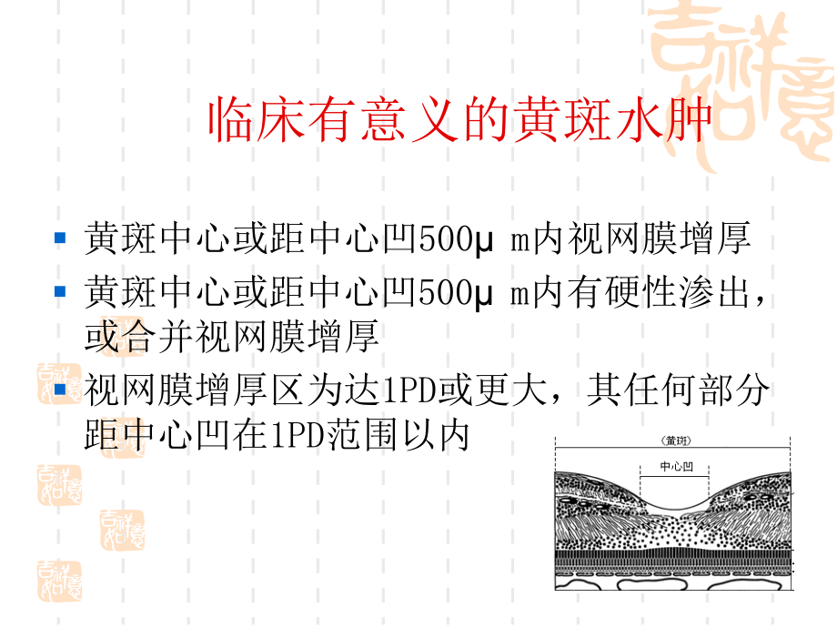 糖尿病性黄斑水肿.ppt_第3页