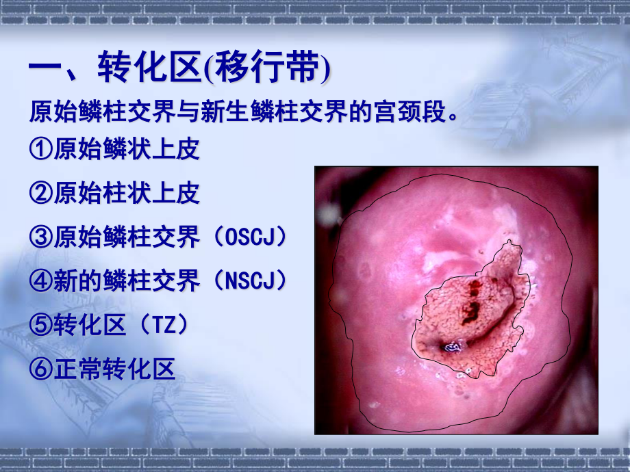 宫颈病变几个重要概念及问题思考.ppt_第3页