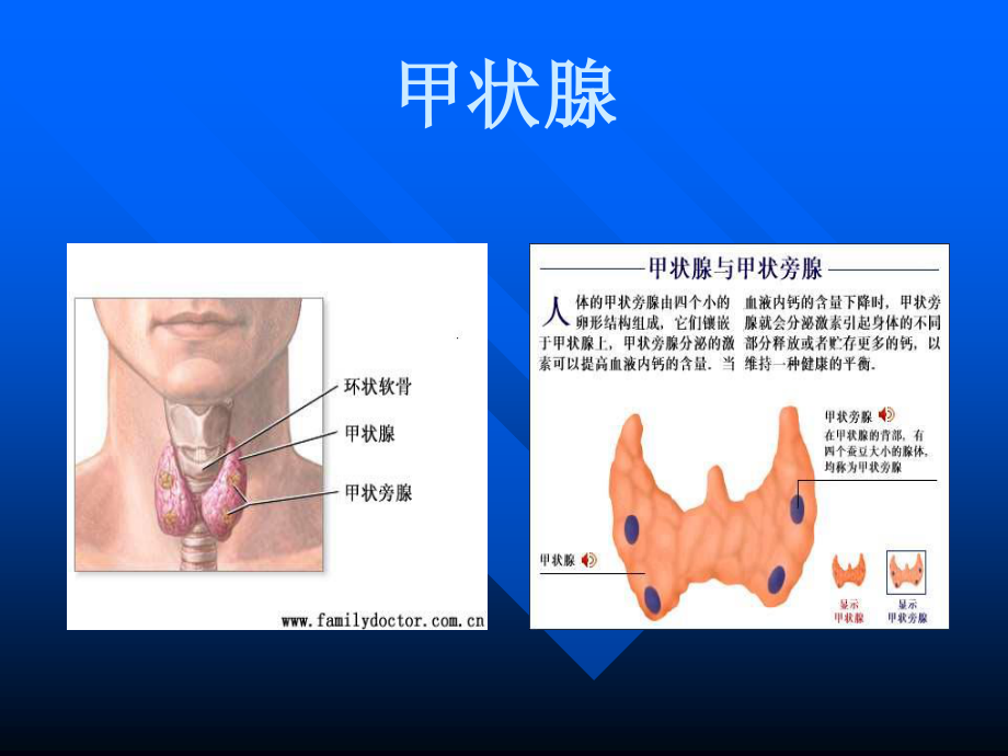 甲状腺结节(内训资料).ppt_第3页