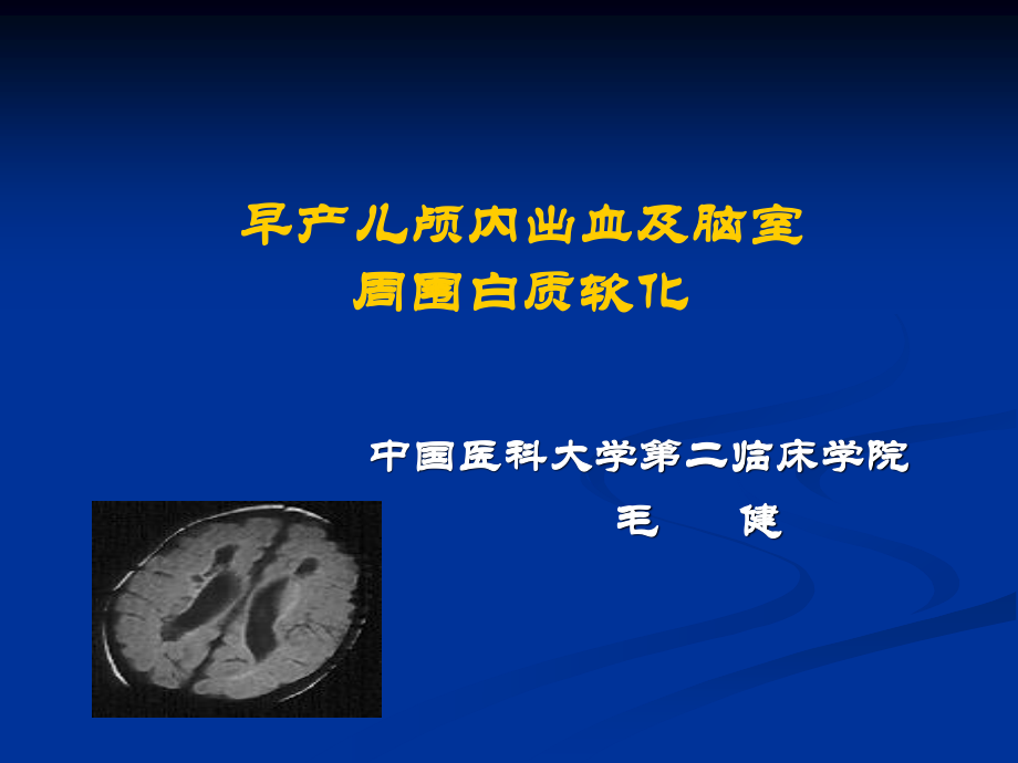 早产儿颅内出血及脑室周围白质软化--中国医大盛京医院.ppt_第1页