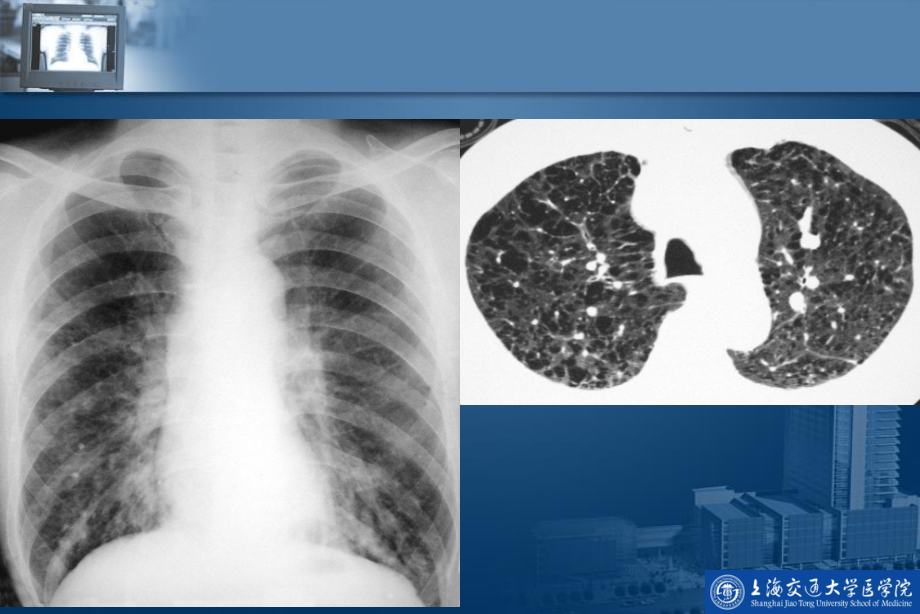 呼吸系统影像学检查.ppt_第3页