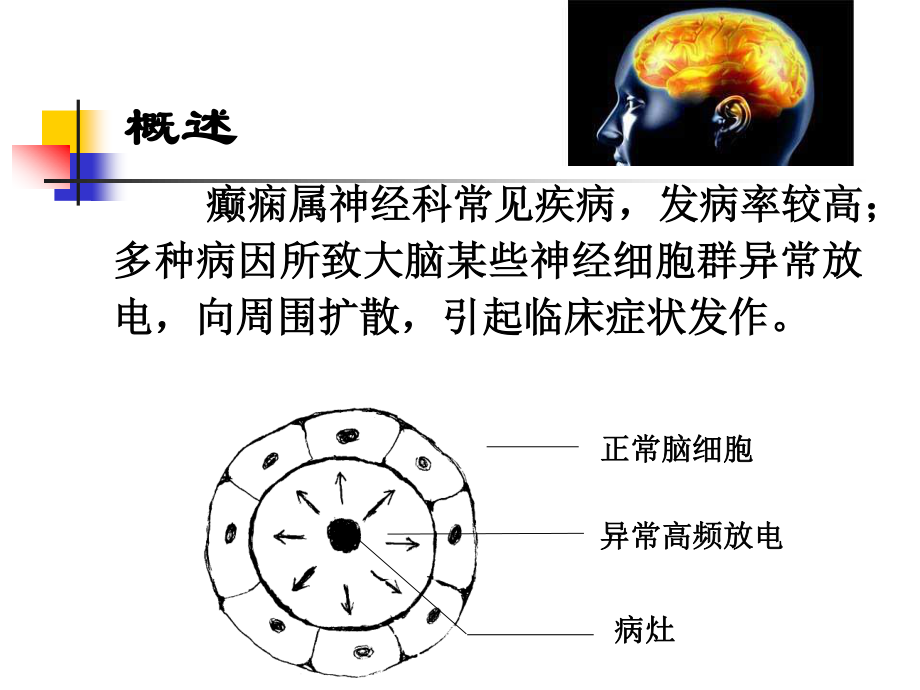 抗癫痫及抗惊厥药.ppt_第2页