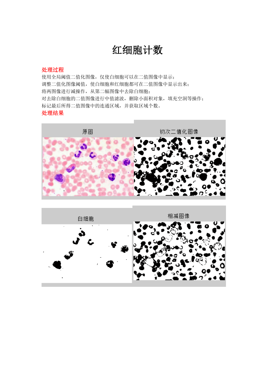 图像处理—红细胞计数(Matlab).doc_第1页