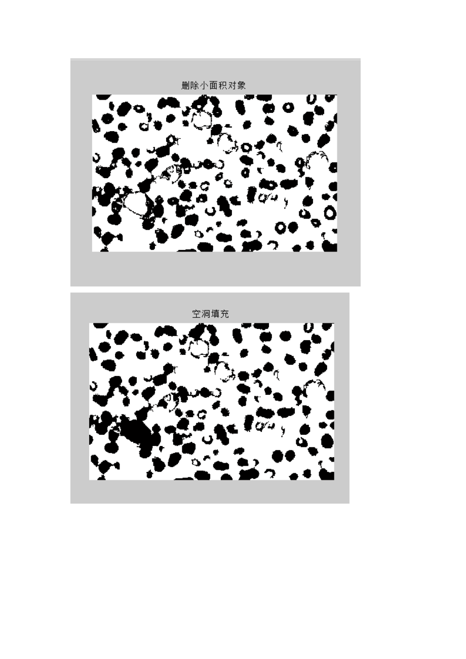 图像处理—红细胞计数(Matlab).doc_第2页