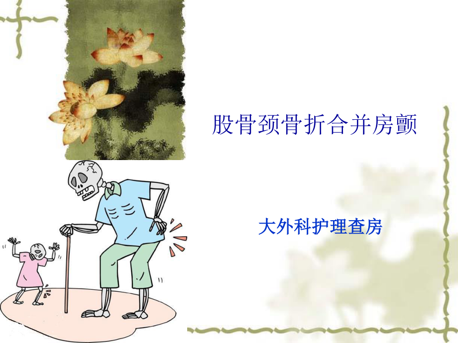 大外科：股骨颈骨折.ppt_第1页